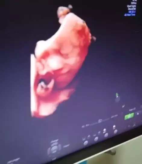 usg seleb © 2020 brilio.net