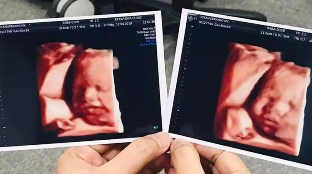 usg seleb © 2020 brilio.net