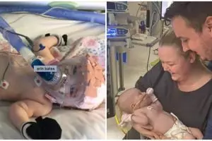 Kisah perjuangan bayi 6 bulan melawan corona ini penuh haru