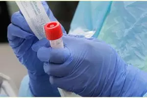 Selain paru-paru, Covid-19 juga bisa serang jantung dan ginjal