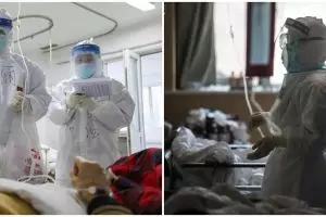 Warna kulit dokter Wuhan menghitam karena corona, ini potretnya