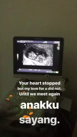 curhat artika sari devi keguguran © 2020 brilio.net