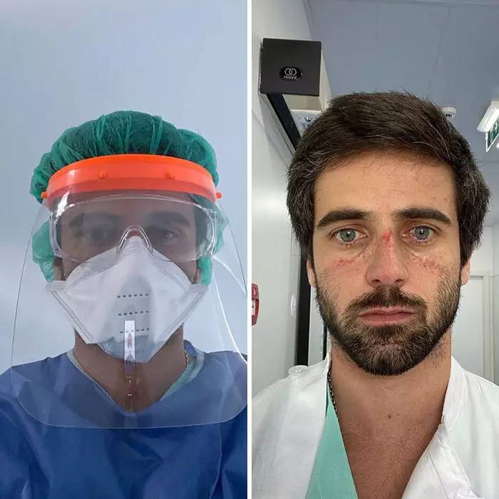 Potret mengharukan tim medis Istimewa