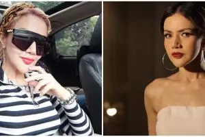 Akui lakukan operasi plastik, ini wajah asli Barbie Kumalasari