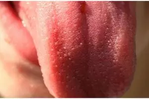 Kisah pria nekat potong lidahnya demi tangkal corona