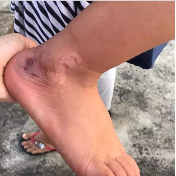 Anak Zaskia © 2020 brilio.net Anak Zaskia © 2020 brilio.net