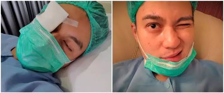 8 Potret Baim Wong jalani operasi mata, alasannya tak terduga