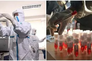 Kabar baik, antibodi virus corona telah ditemukan