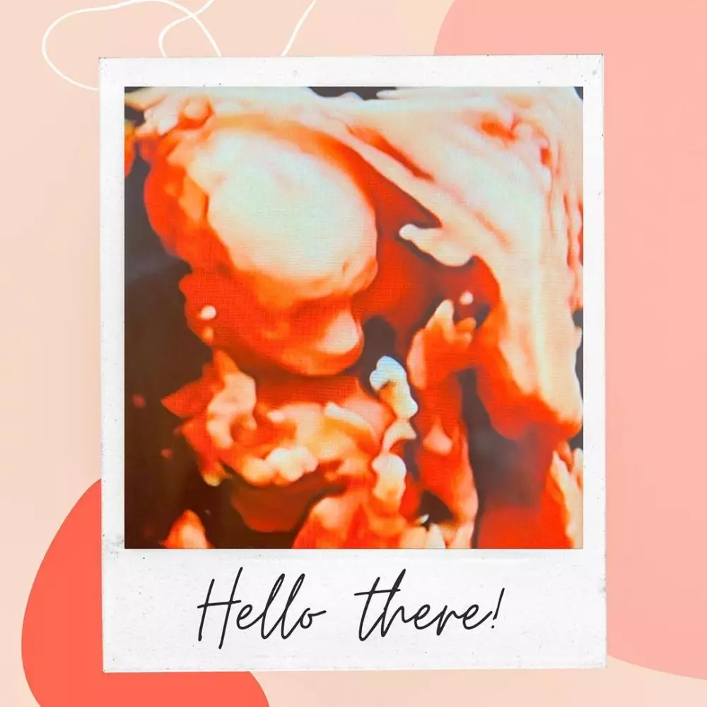 Irish usg paras bayi instagram Irish usg paras bayi instagram