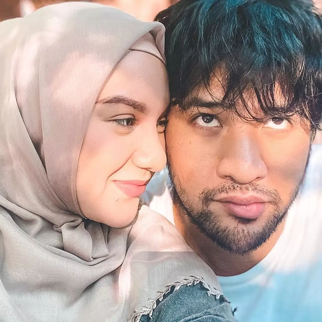 Irish Bella unggah foto USG buah hati, hidung sang bayi curi perhatian