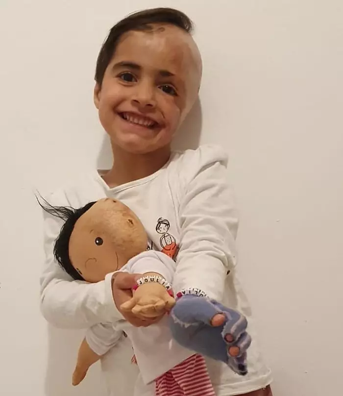 Potret boneka khusus disabilitas Instagram/@a_doll_like_me Potret boneka khusus disabilitas Instagram/@a_doll_like_me