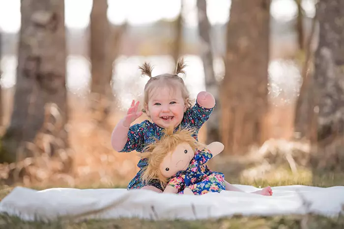 Potret boneka khusus disabilitas Instagram/@a_doll_like_me Potret boneka khusus disabilitas Instagram/@a_doll_like_me