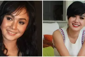 Potret 10 seleb cantik sebelum vs sesudah veneer gigi, manglingi