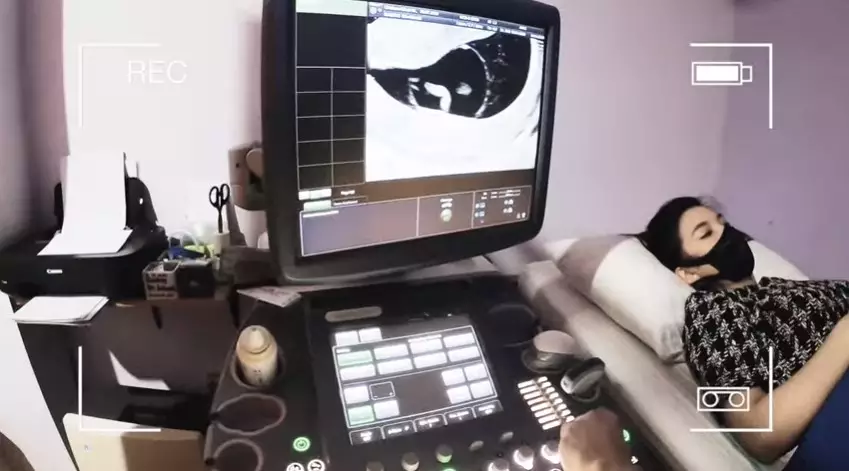 Chelsea Olivia hamil anak kedua Berbagai sumber Chelsea Olivia hamil anak kedua Berbagai sumber