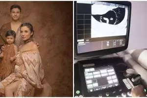 Ungkapan bahagia Chelsea Olivia hamil anak kedua