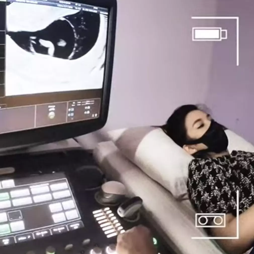 Ungkapan bahagia Chelsea Olivia hamil anak kedua