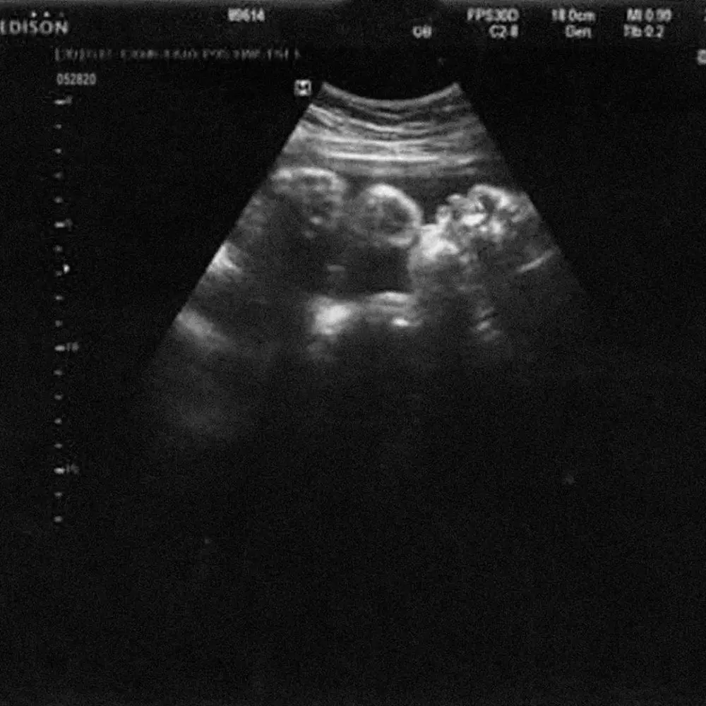 Nadin Amizah keluarkan album Selamat Ulang Tahun © 2020 brilio.net