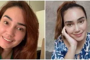 6 Fakta Feby Febiola jelang operasi kista ovarium, tetap optimis