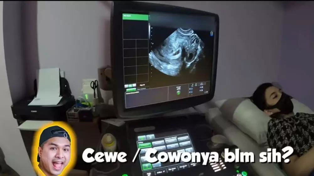 chelseaoliviaa berbagai sumber  chelseaoliviaa berbagai sumber