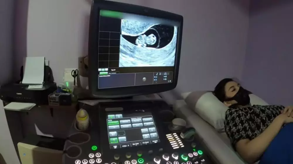 chelseaoliviaa berbagai sumber  chelseaoliviaa berbagai sumber