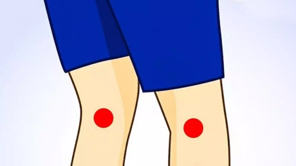 Cara mudah atasi nyeri punggung Istimewa