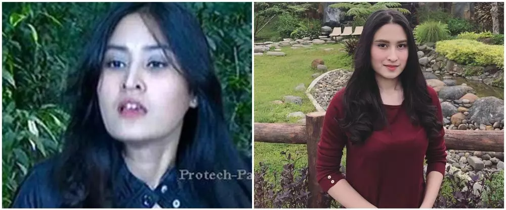 Potret terkini pemain Ganteng Ganteng Serigala © 2020 brilio.net Potret terkini pemain Ganteng Ganteng Serigala © 2020 brilio.net