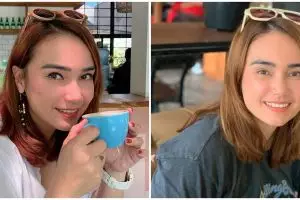 Jalani operasi kista ovarium, ini kondisi terbaru Feby Febiola