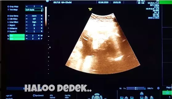 Citra Kirana dan Rezky © 2020 brilio.net