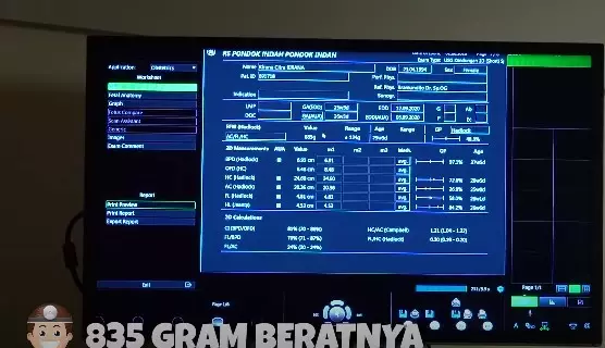 Citra Kirana dan Rezky © 2020 brilio.net