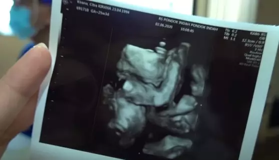 Citra Kirana dan Rezky © 2020 brilio.net