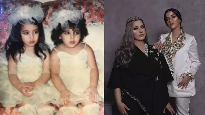 Transformasi artis kembar berbagai sumber 