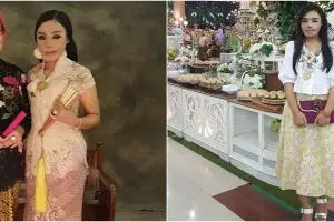 Ingat Lisa 'face off' korban siram air keras? Ini 6 kabar terkininya