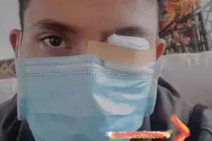 Gara-gara abu rokok pemotor lain, mata pengendara ini diperban