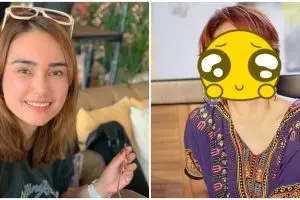 Usai jalani operasi, ini 5 potret Feby Febiola dengan rambut baru
