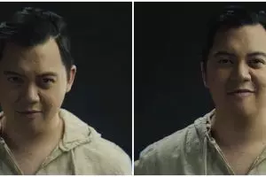 3 Cerita di balik operasi batu ginjal Chandra Liow, obesitas 115 kg