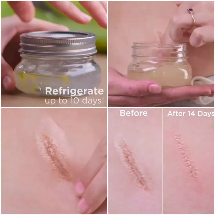 Lifehack merawat tubuh alami Twitter/@BlossomHacks Lifehack merawat tubuh alami Twitter/@BlossomHacks