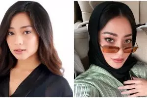 Potret 7 seleb sebelum dan sesudah perawatan botox, ada Nikita Willy