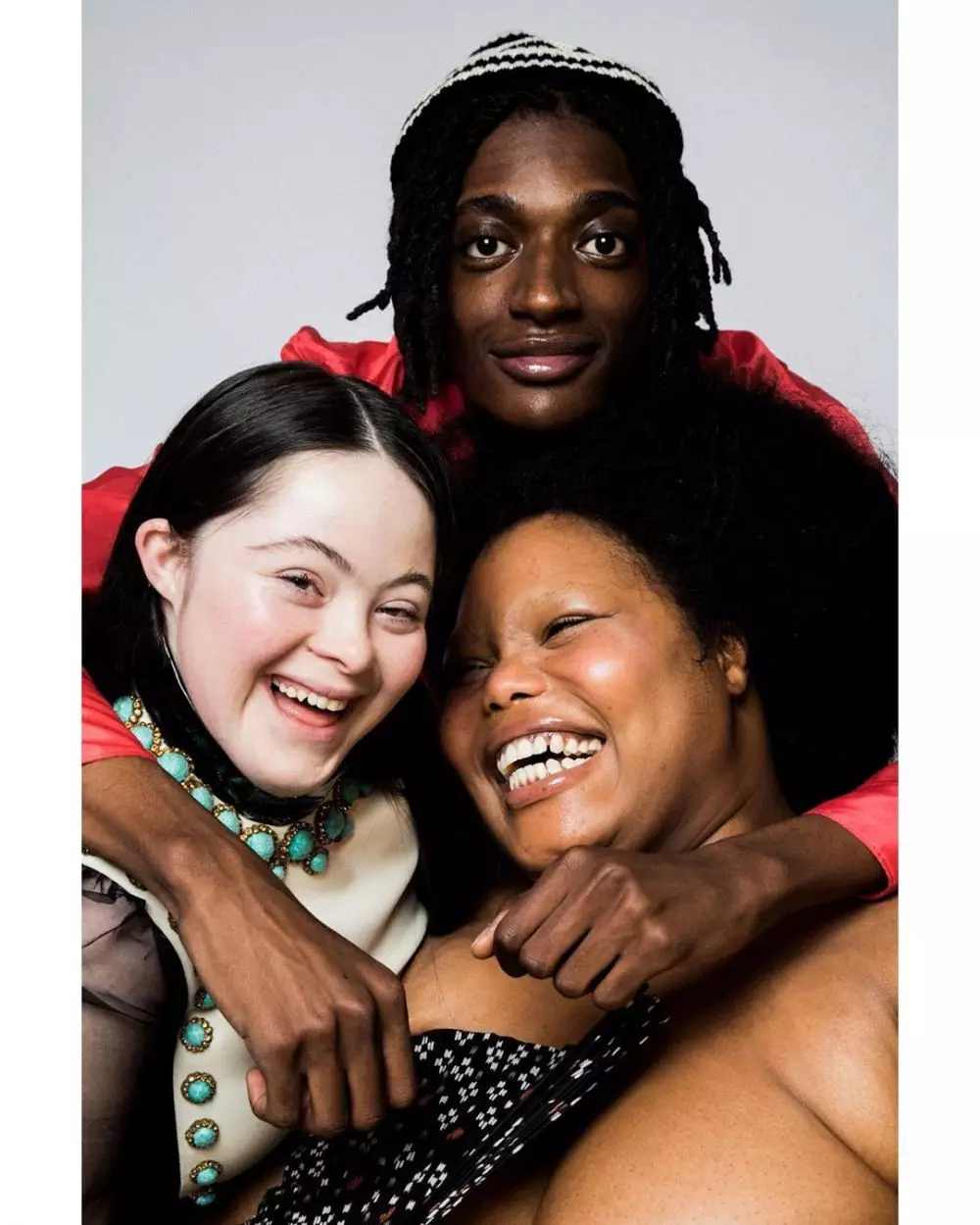 Fakta Ellie Goldstein © 2020 brilio.net Fakta Ellie Goldstein © 2020 brilio.net