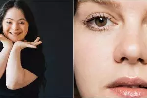 5 Fakta Ellie Goldstein, gadis down syndrome yang jadi model Vogue