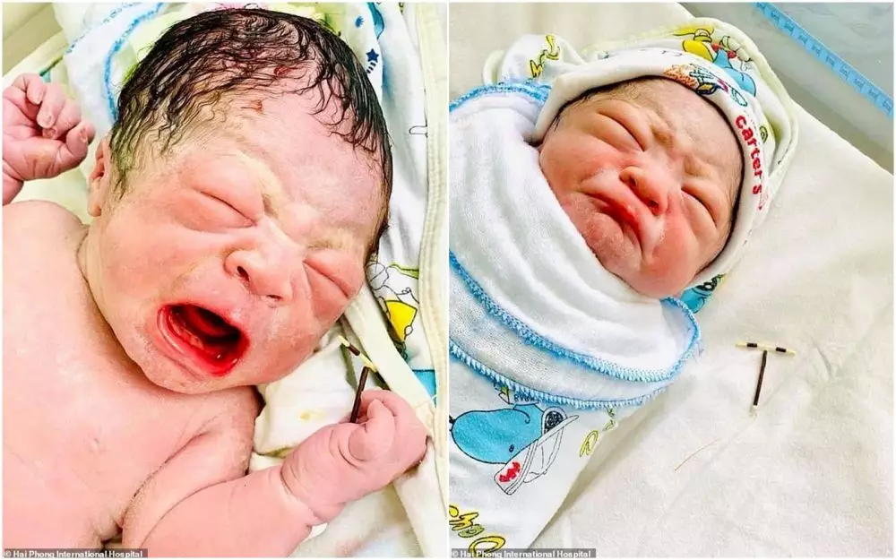 Bayi genggam kontrasepsi © 2020 brilio.net