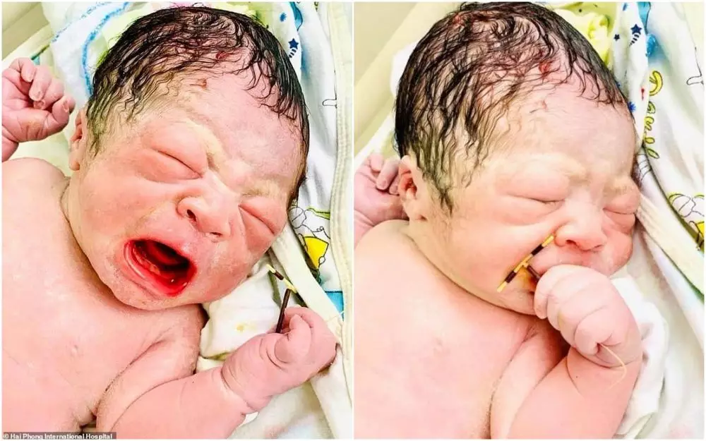 Bayi genggam kontrasepsi © 2020 brilio.net