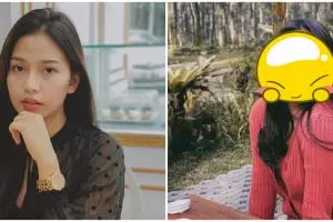 7 Penampilan terbaru selebgram Dara Arafah usai operasi hidung