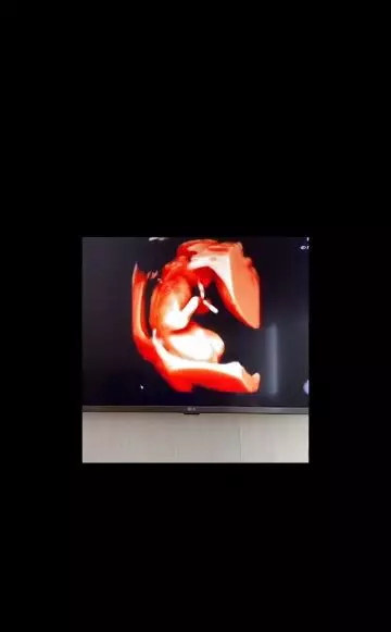 angbeen rishi umumkan kehamilan Instagram angbeen rishi umumkan kehamilan Instagram