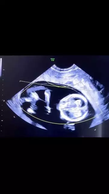 angbeen rishi umumkan kehamilan Instagram angbeen rishi umumkan kehamilan Instagram