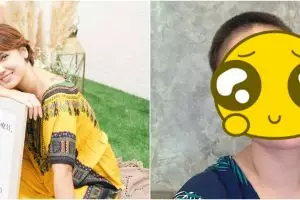 Curhat Feby Febiola usai kemoterapi, rambut dicukur botak