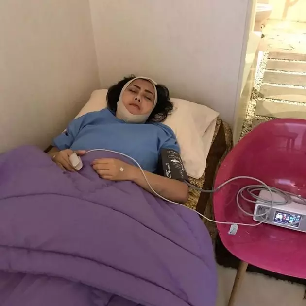 rency bengkak Instagram