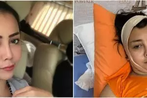 7 Potret perubahan wajah Rency Milano usai perawatan kecantikan