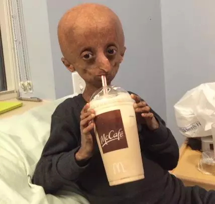 sindrom langka berbagai sumber