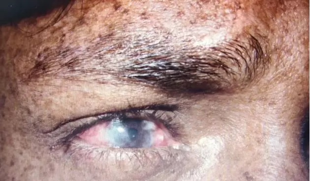 sindrom langka berbagai sumber