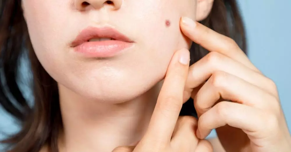 Manfaat bawang merah untuk kecantikan © 2020 brilio.net Manfaat bawang merah untuk kecantikan © 2020 brilio.net